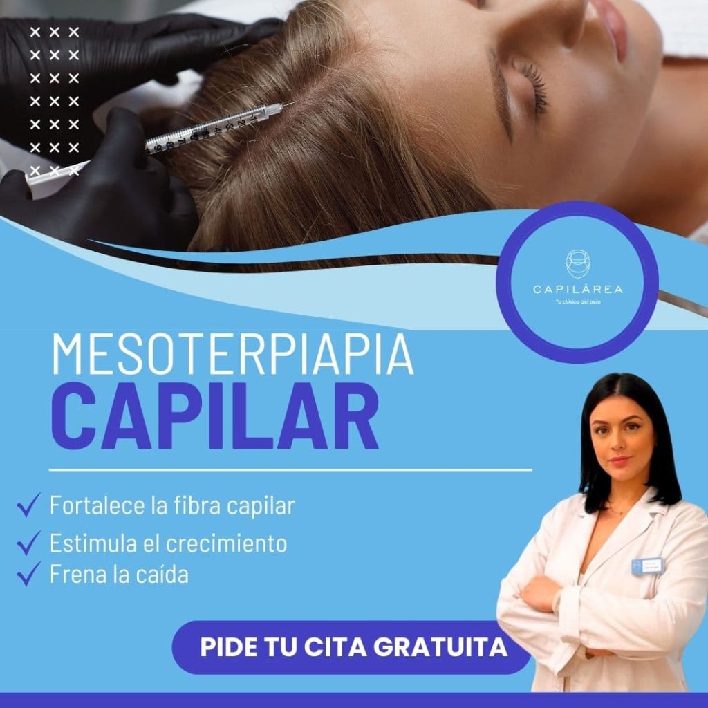 Mesoterapia capilar clínica capilar capilárea Madrid banner cita