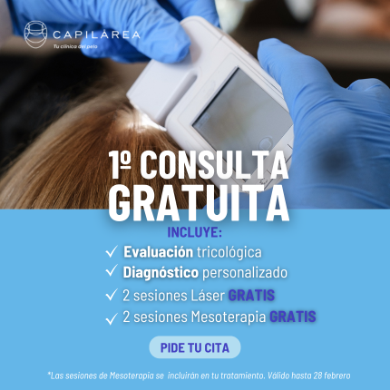 Consulta capilar Madrird