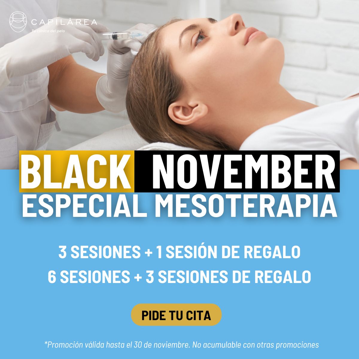 Mesoterapia capilar madrid promoción Black Friday