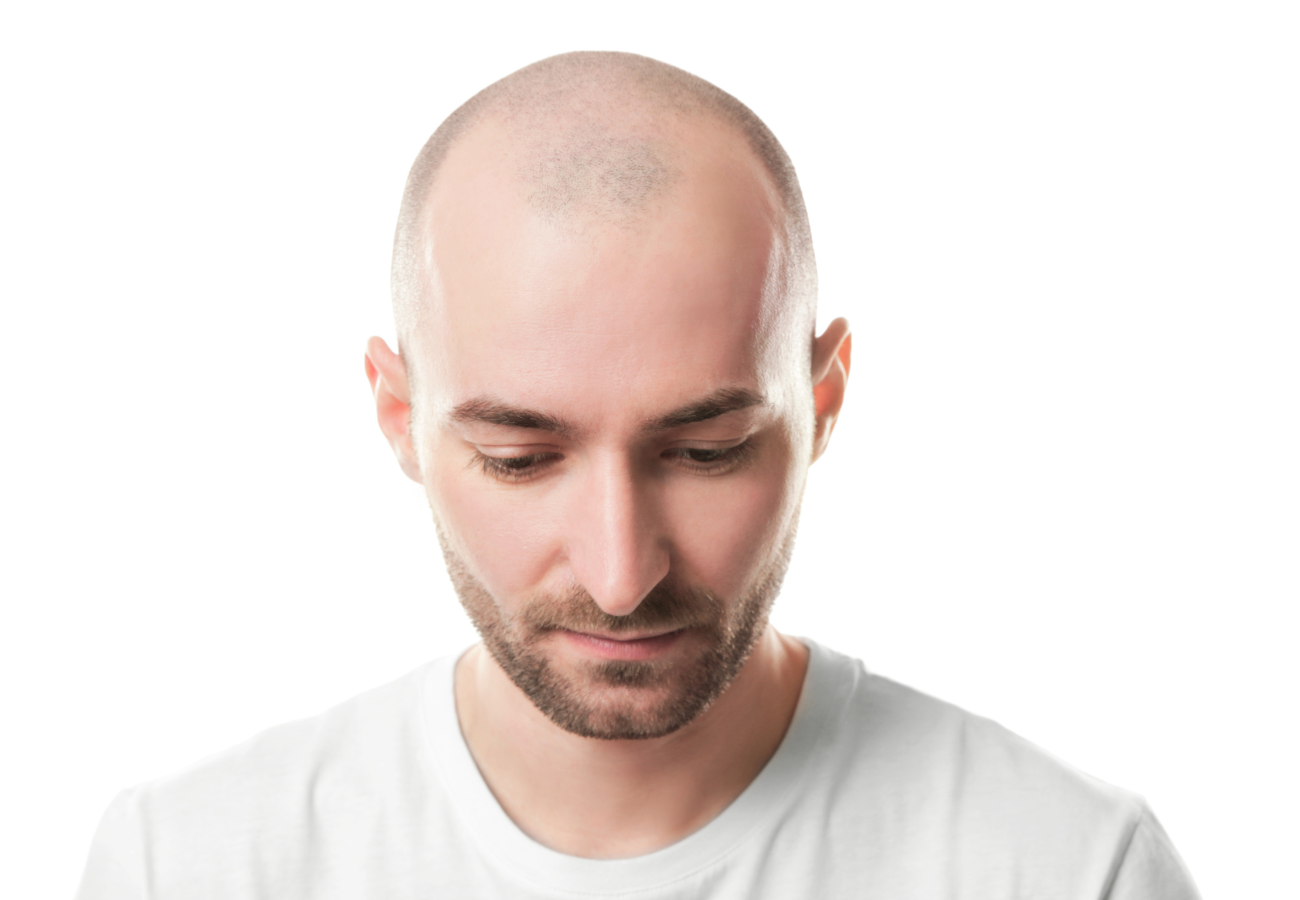 gel desoxirribosa para la alopecia