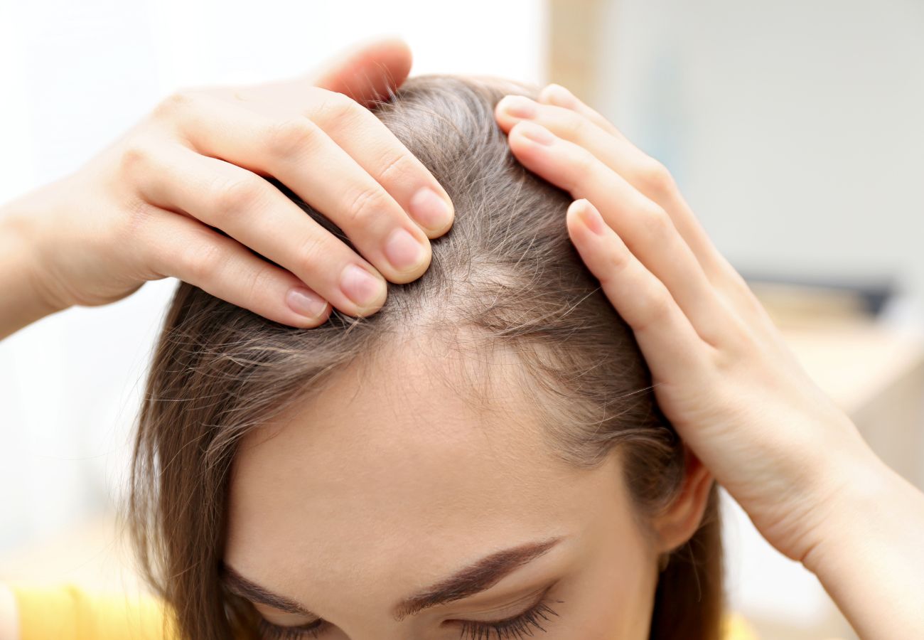 Cómo evitar o prevenir la caída del pelo